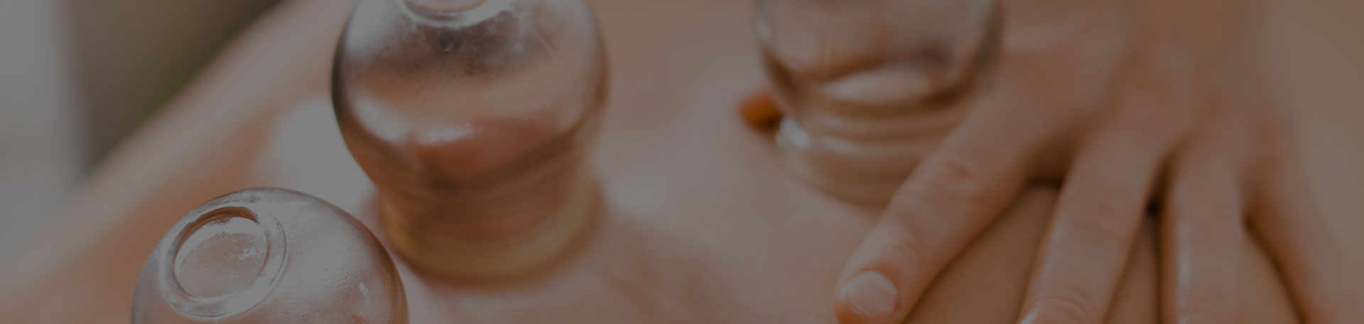 Séance de cupping thérapie près d'Orléans